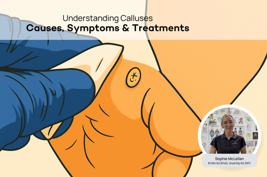 What Are Calluses? A Podiatrist Explains the Causes and Treatment